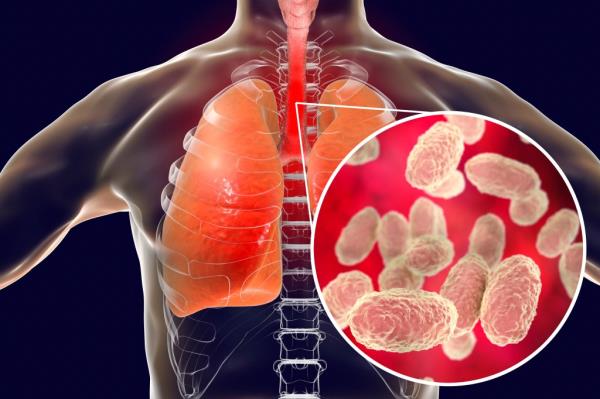 Whooping cough bacteria Bordetella pertussis in human airways